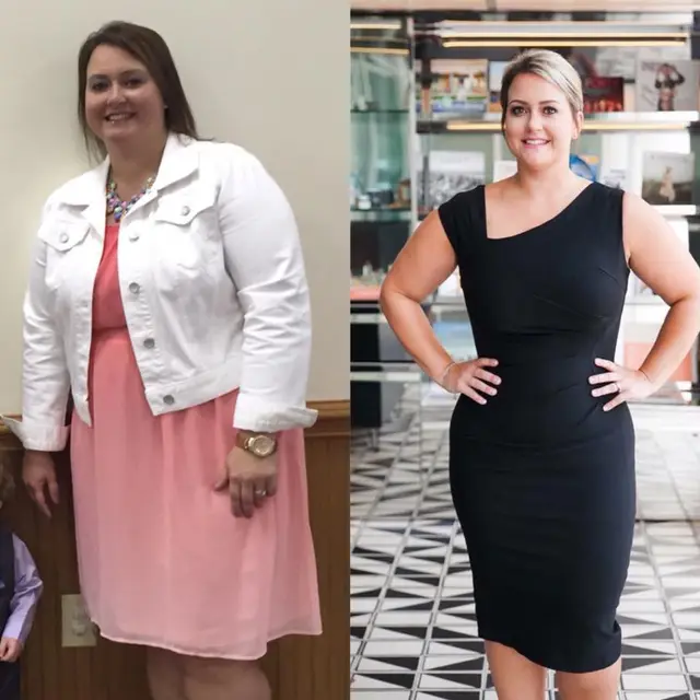Michelle before and after